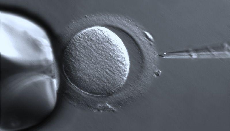 Axiovert 5 多功能应用研究级倒置显微镜