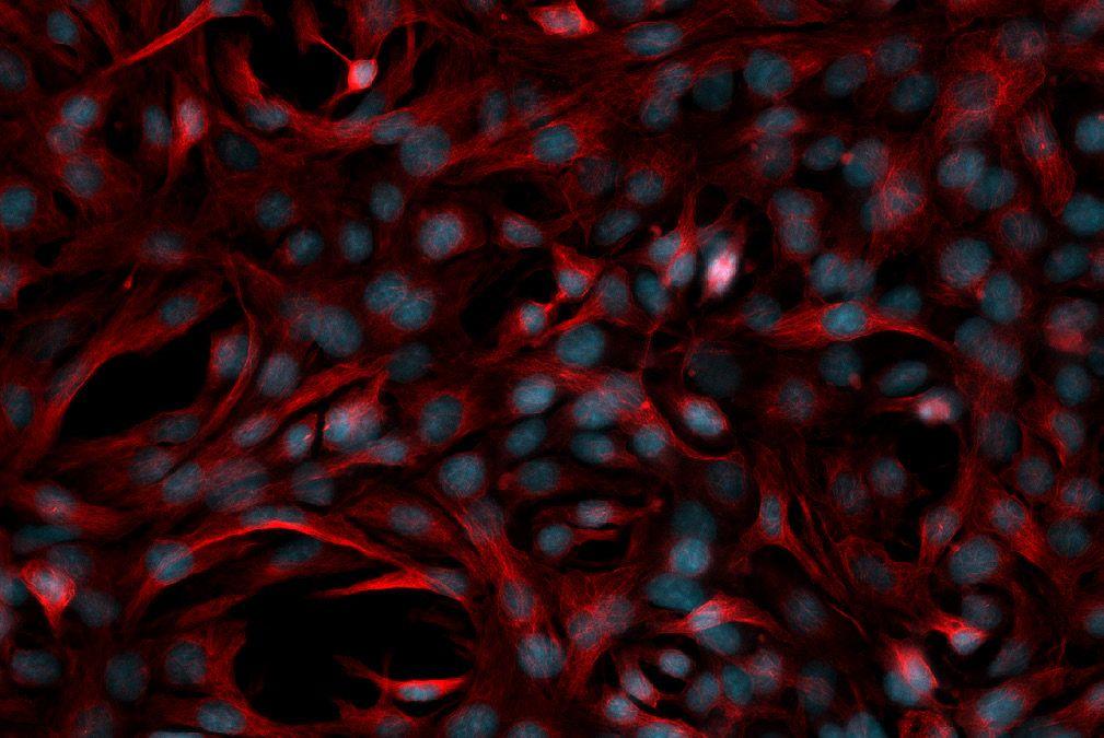 Axiovert 5 多功能应用研究级倒置显微镜